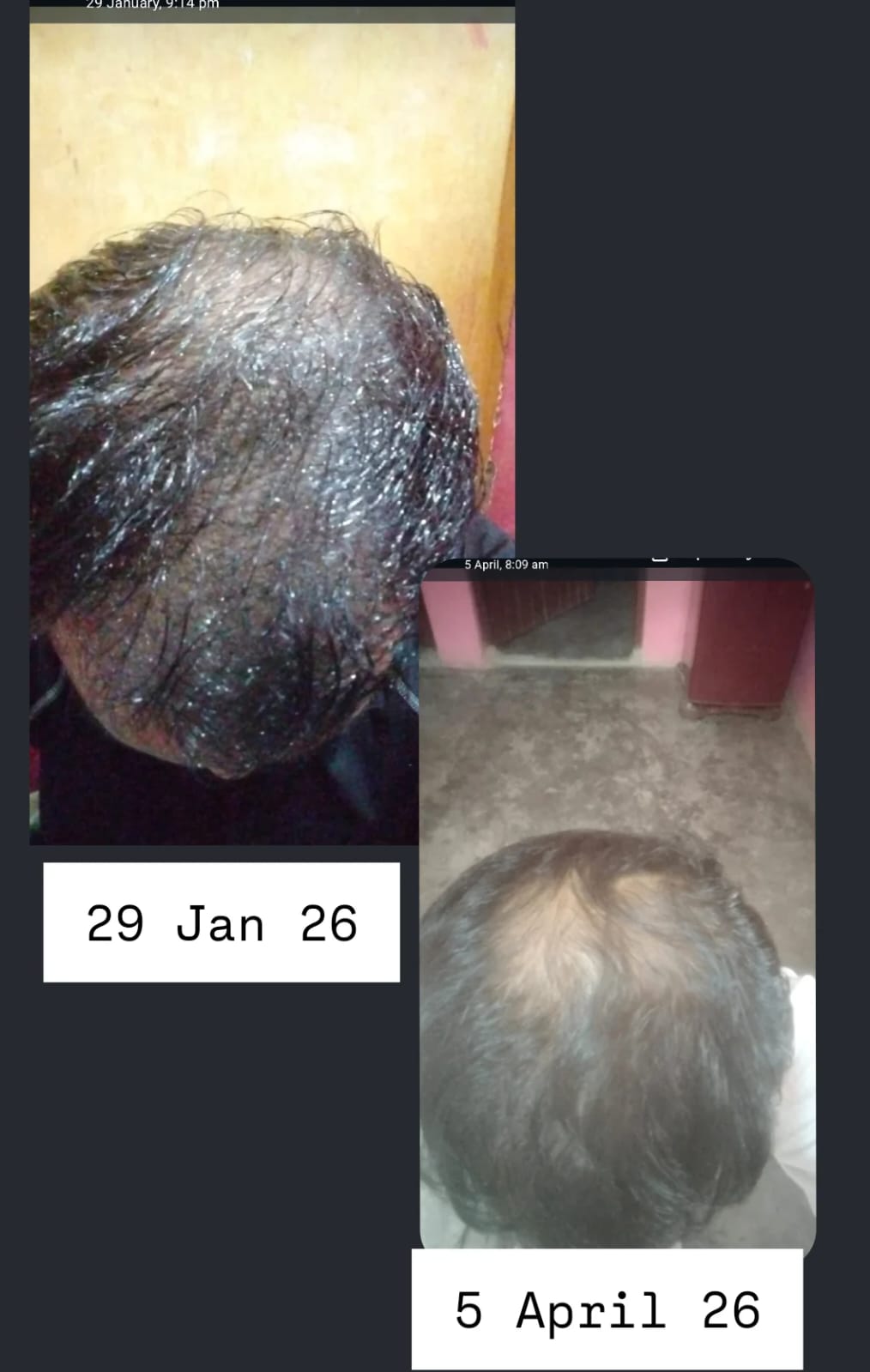 Natgenic customer result 3